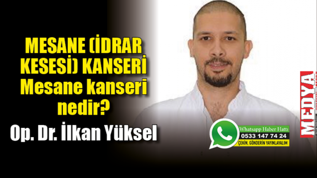 MESANE (İDRAR KESESİ) KANSERİ  Mesane kanseri nedir?