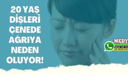 20 YAŞ DİŞLERİ ÇENEDE AĞRIYA NEDEN OLUYOR!