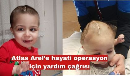 Atlas Arel’e hayati operasyon için yardım çağrısı