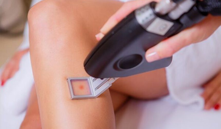 Elit Klinik Fraksiyonel Lazer Uygulamaları ile Cildinizi Yenileyin!