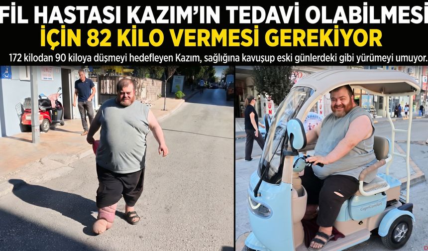 Kazım'ın tedavi olabilmesi için 82 kilo vermesi gerekiyor